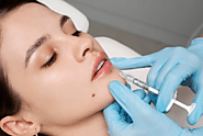 Unlocking the Beauty With A Lip Flip Treatment in California