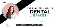 The Complete Guide to Dental Braces