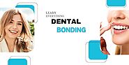 Everything You Want About Dental Bonding - A Hub of Ideas and Exploration with Global Blogs