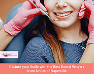 Restore your Smile with the Best Dental Veneers from Smiles of Naperville