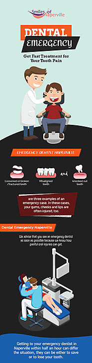 Smiles of Naperville – A Team of Emergency Dentists in Naperville, IL