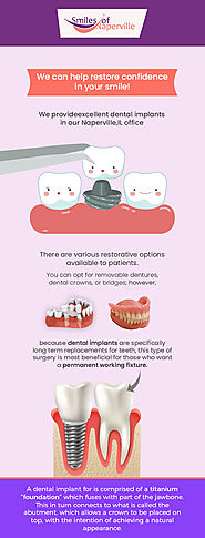 Transform your Smile with Quality Dental Implants in Naperville, IL from Smiles of Naperville