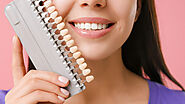 5 Reasons to Consider Dental Veneers