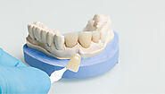 Do Dental Crowns Get Stained?