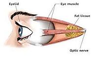 Website at https://www.business-spot.com/examining-the-treatment-options-for-thyroid-eye-disease/