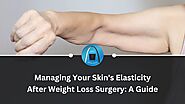 A Complete Guide to Handle Your Skin's Elasticity After Weight Loss Surgery
