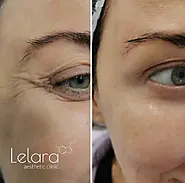 Premium Botox Treatments in Dubai- Lelara Aesthetic Clinic