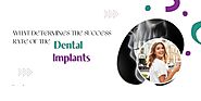 What Determines the Success Rate of the Dental Implants? - Thefiveguysenterprises