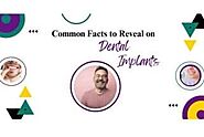 Common Facts to Reveal on Dental Implants