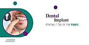 Dental Implant After Care: 7 Tips for Your Implants