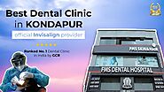 Best Dental Clinic in Kondapur | FMS Dental Clinic | Best Invisalign Provider in Kondapur
