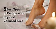 5 Best Types of Pedicure for Dry and Callused Feet