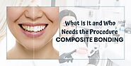 Composite Bonding: What Is It and Who Needs the Procedure?