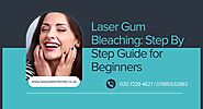 Laser Gum Bleaching: Step By Step Guide for Beginners 