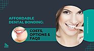 Affordable Dental Bonding: Costs, Options & FAQs