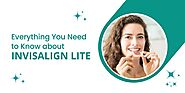 Everything You Need to Know about Invisalign Lite | Ultimate Guide - The Blog Bridge