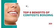 Top 6 Benefits of Composite Bonding - incidentalseventy