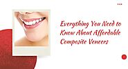 Everything You Need to Know About Affordable Composite Veneers