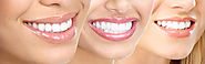 Jaw Surgery, Cosmetic Dentistry in Ashok Vihar, Delhi