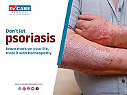 Homeopathy treatment for psoriasis - Dr Care Homeopathy