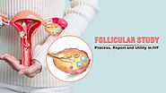 Follicular Study: Scan, Process, Report and Utility in IVF
