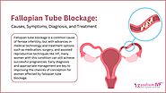 Fallopian Tube Blockage – Causes, Symptoms, Diagnosis, and Treatment