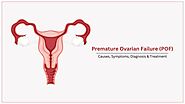 Premature ovarian failure (POF) Causes, Symptoms, Diagnosis & Treatment