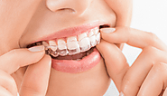 How to Care for Your Teeth with Invisalign?