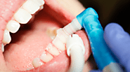 7 Tips to Make Your Dental Cleaning Last Longer