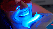 How Does Teeth Whitening Work?