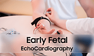 Early Fetal Echocardiography - Pregnancy Counselors