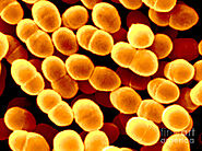 B) Lactococcus lactis