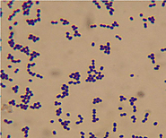 Cell Morphology of Lactococcus lactis