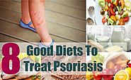 Psoriasis diet