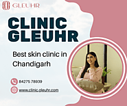 Best Skin Clinic in Chandigarh - Clinic Gleuhr