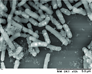 (B) Electron microscopic image of gram positive Lc. paracasei
