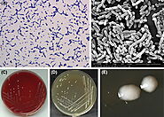 Potential Microbiological Risks associated with Lacticaseibacillus paracasei
