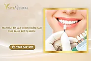 Mặt dán sứ: Lựa chọn hoàn hảo cho răng đẹp tự tin - Nha Khoa Thẩm Mỹ VSiTa Dental - Việt Nam