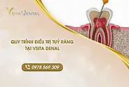 Quy trình điều trị tủy răng tại VSiTa Dental - Nha Khoa Thẩm Mỹ VSiTa Dental - Việt Nam