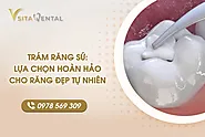 Trám Răng: Lựa Chọn Hoàn Hảo Cho Răng Đẹp Tự Nhiên