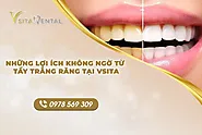 Những Lợi Ích Không Ngờ Từ Tẩy Trắng Răng Tại VSiTa