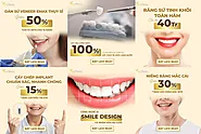 Dán sứ Veneer Emax Thụy Sĩ chỉ từ 56tr - giảm sốc 50% trong tháng phái đẹp - Nha Khoa Thẩm Mỹ VSiTa Dental - Việt Nam