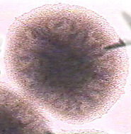 Bacillus subtilis - microbewiki