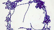 Gram positive, rod-shaped Bacillus subtilis