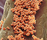 Lactococcus lactis bacteria, SEM.