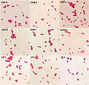 Characteristics of Tetragenococcus halophilus that make it suited for Fermentaion in High Salt Concentrations