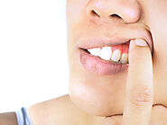 Common Gum Diseases & How to Treat Them - Smile Every Day Dentistry