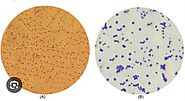 Characteristics of Lactococcus lactis