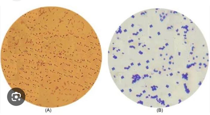 Adopting fermenting bacteria (Lactococcus lactis) for Amasi food | A ...