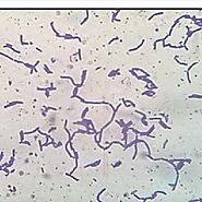 Microscopic image of Lactobacillus plantarum